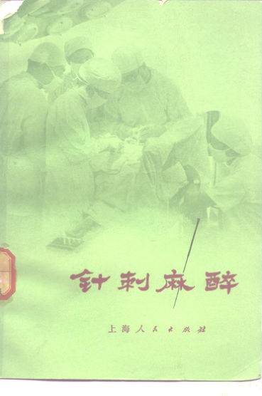 针刺麻醉_10265903