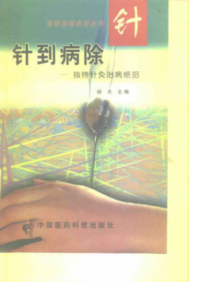 针到病除独特针灸治病绝招10226648