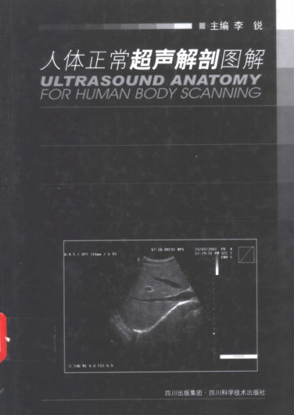 人体正常超声解剖图解_李锐主编_成都：四川科学技术出版社_2004.02_11342566